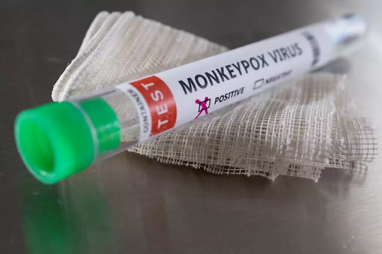 Could Monkeypox Bring a New Wave of Homophobia?