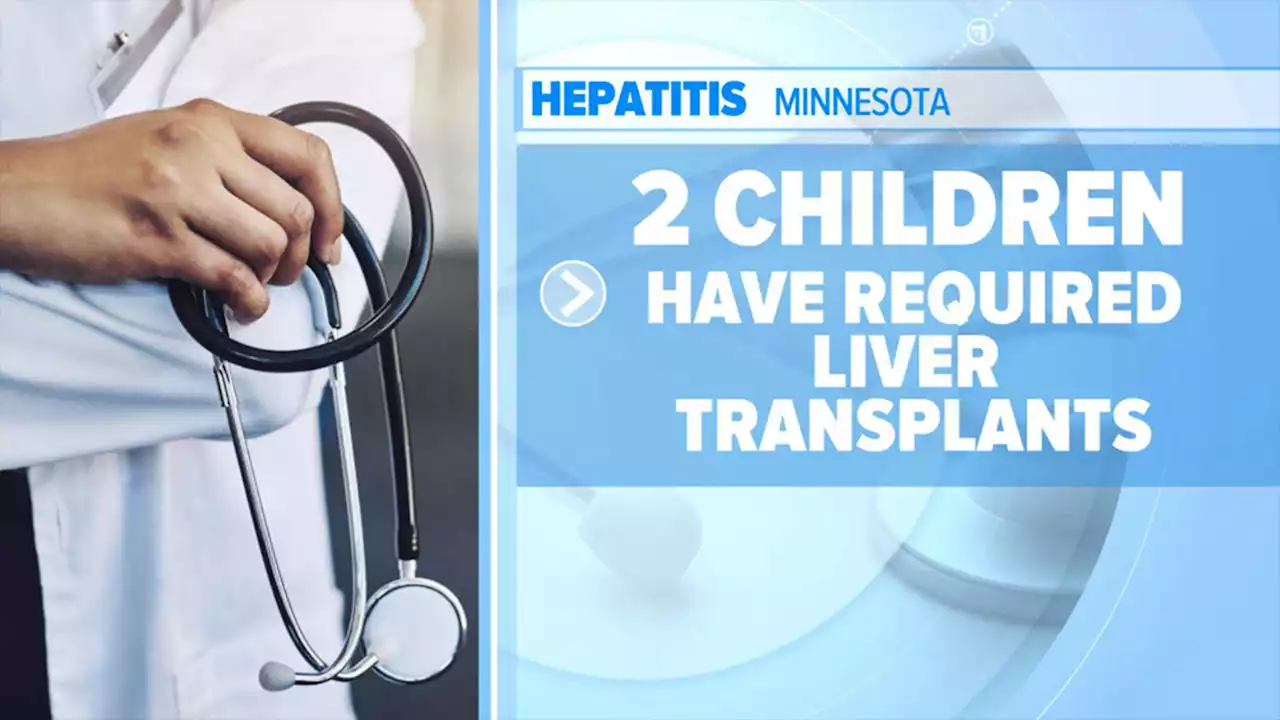 10 states report severe hepatitis in children as researchers investigate mysterious outbreak