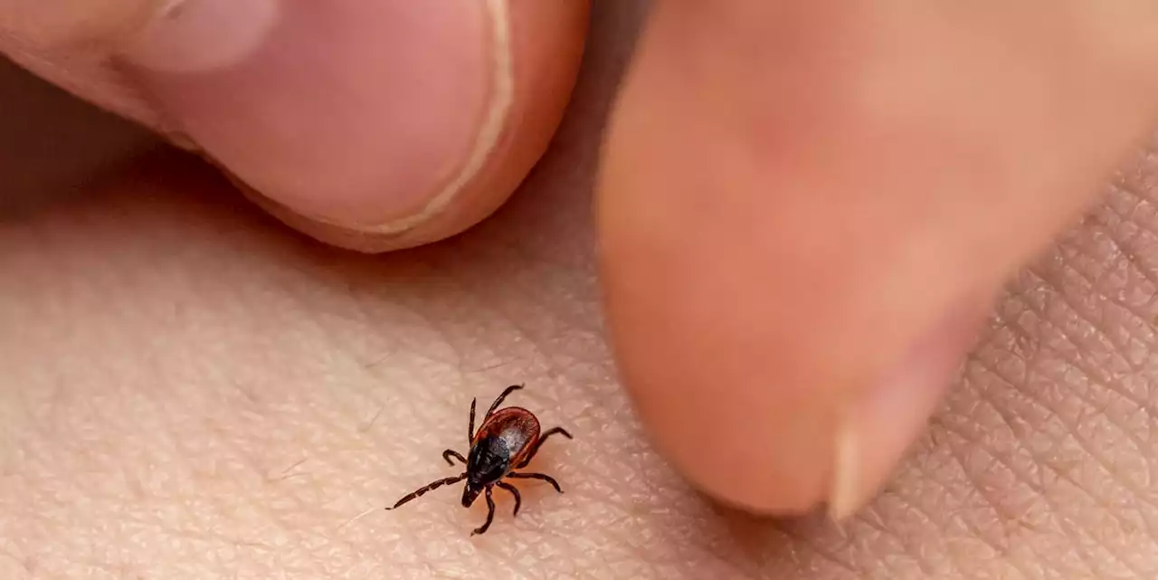 How to Remove a Tick Head the Right Way