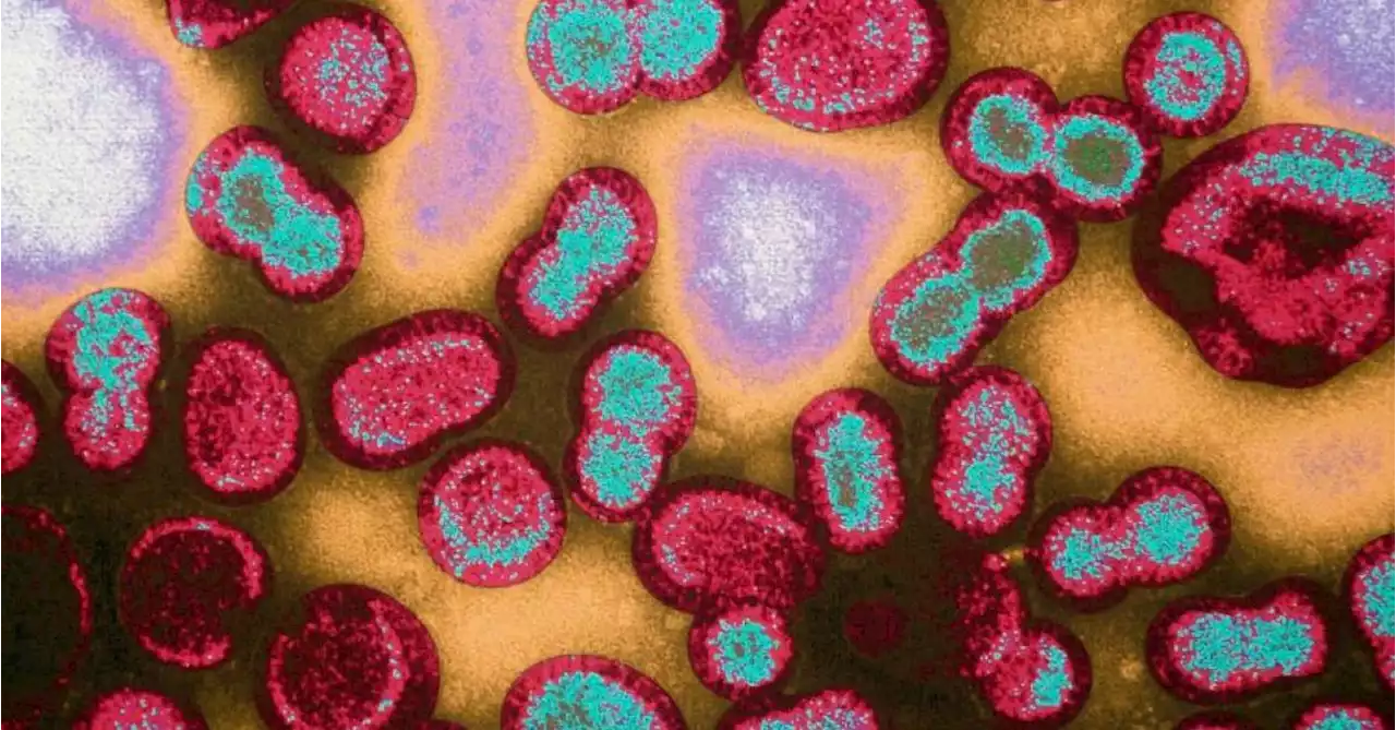 Hépatite infantile: près de 230 cas probables d’hépatite infantile dans le monde, selon l’OMS