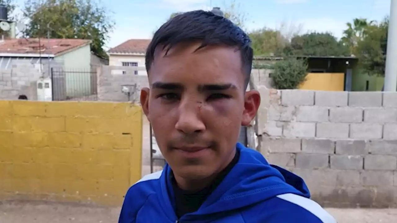 Batalla campal entre menores en un partido de fútbol en Córdoba