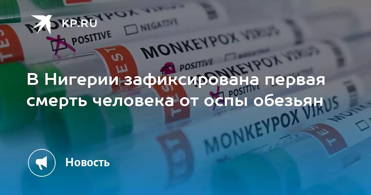 В Нигерии зафиксирована первая смерть человека от оспы обезьян