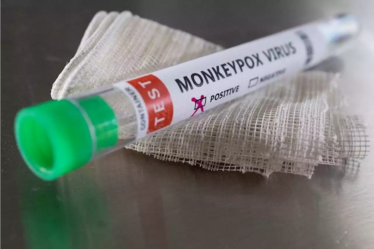 People infected with monkeypox can isolate at home — UKHSA