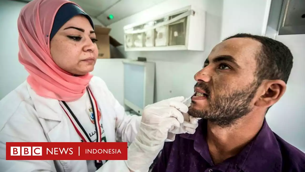 Hepatitis akut, mengapa disebut 'penyakit misterius' dan berbeda dengan tipe-tipe yang sudah ada? - BBC News Indonesia