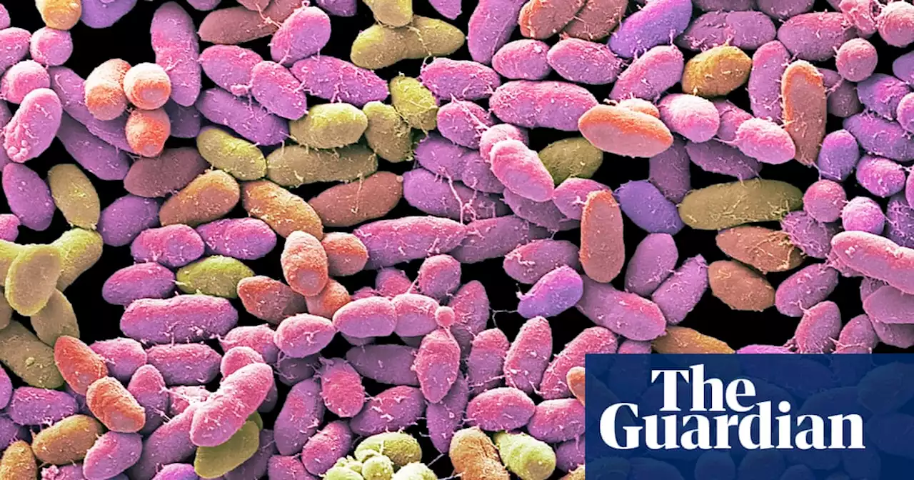 Certain gut microbes may affect stroke risk and severity, scientists find