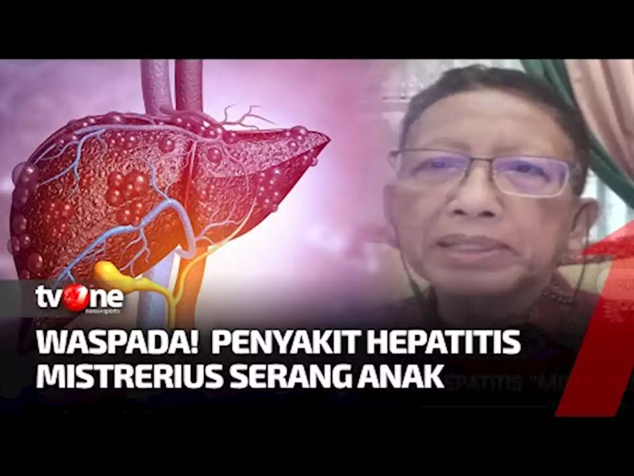 Waspada Hepatitis Akut Misterius Serang Anak, Begini Penjelasan Prof Zubairi - tvOne