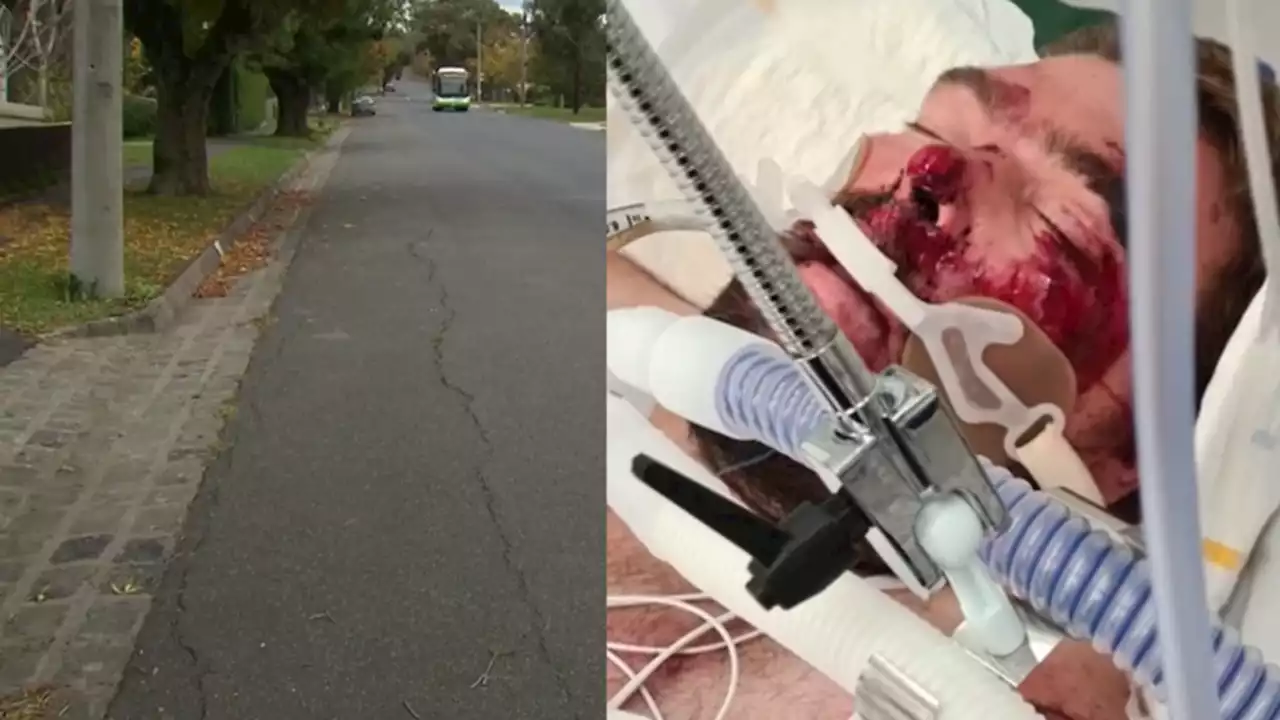 Hit and run leaves footy fan in coma after drunken walk home goes terribly wrong