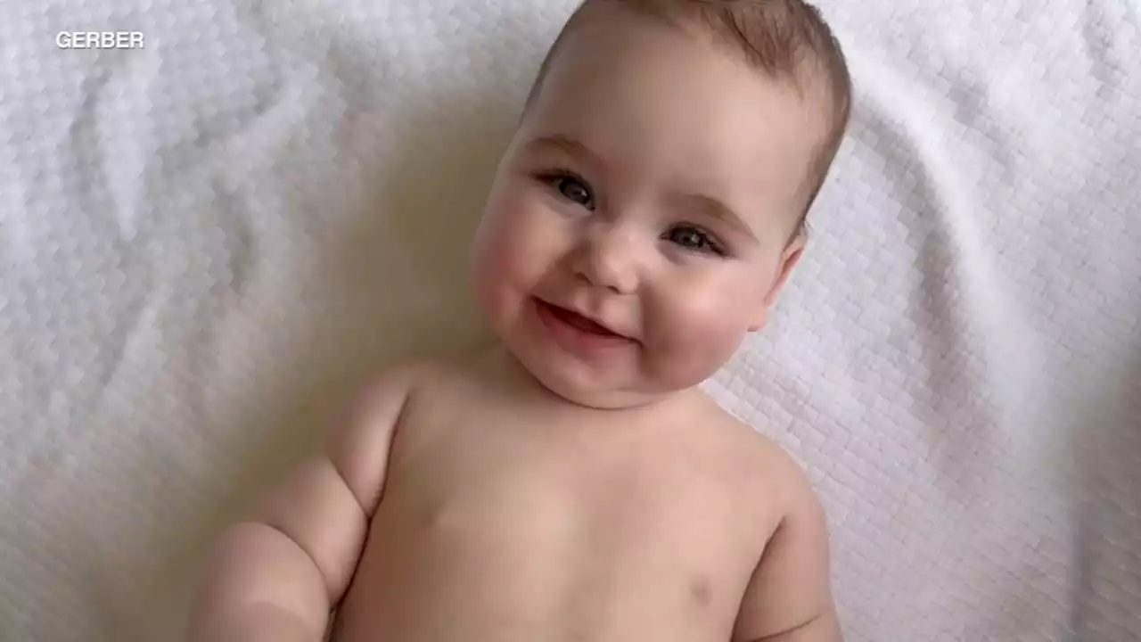 2022 Gerber baby contest winner shines spotlight on limb differences