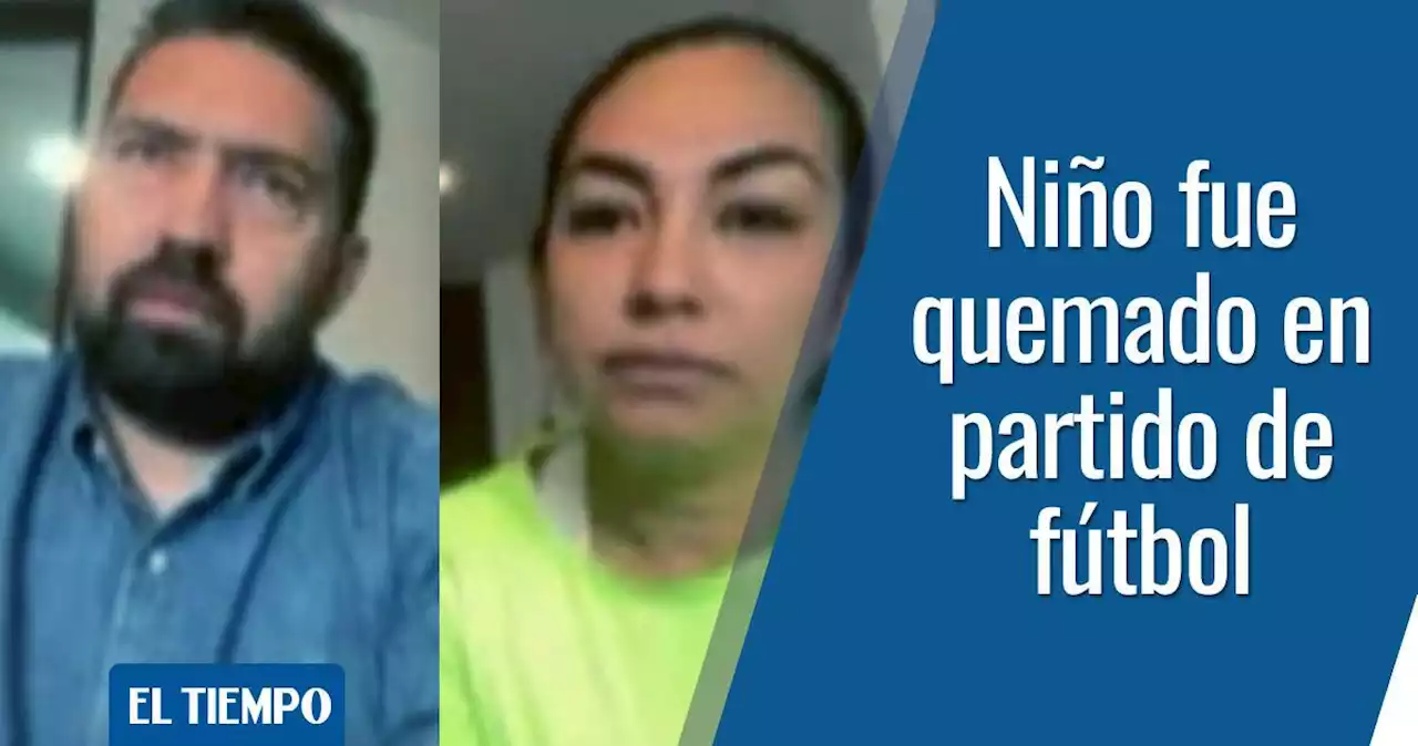 ‘Quemaron a mi hijo de 10 años por una pelea en un partido de fútbol’