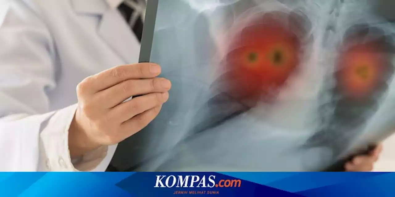 4 Kebiasaan Sehat untuk Mencegah Peradangan Kronis