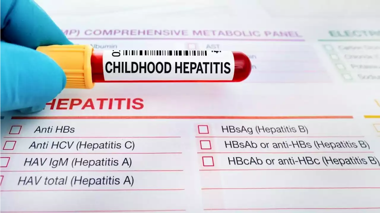 Cuáles son las diferencias entre la nueva 'hepatitis aguda' y las A y B