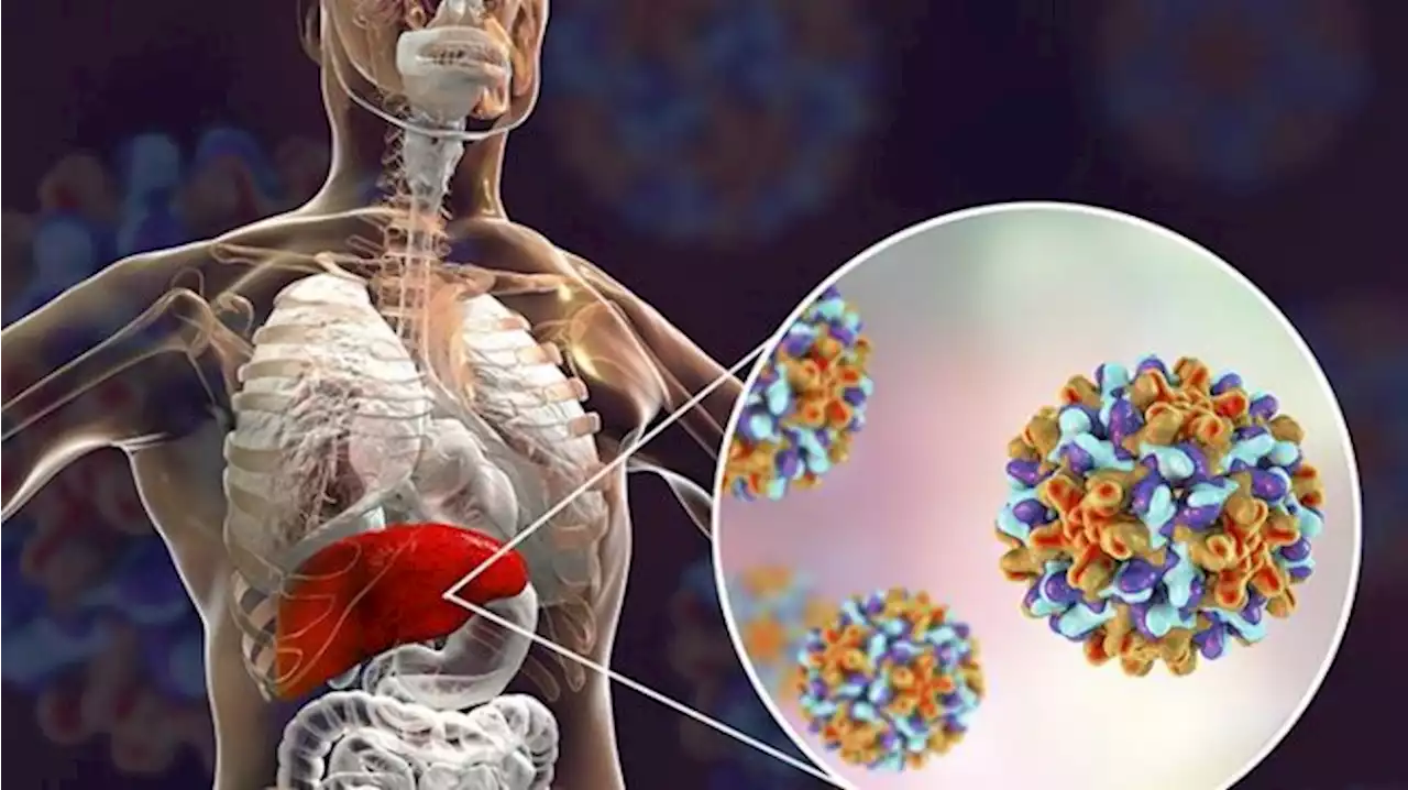 Epidemiolog Singgung Soal Biosurveillance dalam Kasus Hepatitis Akut Misterius