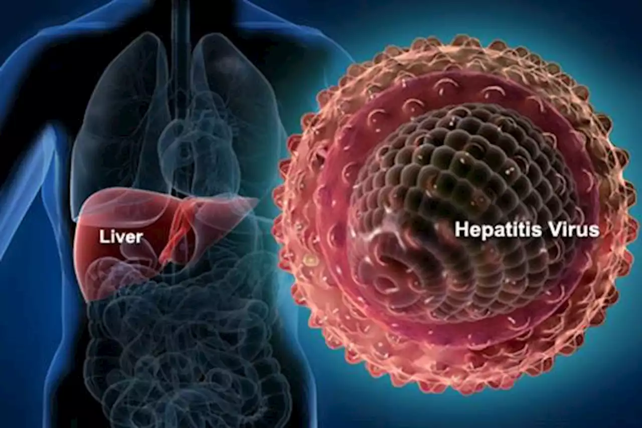 Hepatitis Misterius Serang 300 Anak, Berawal dari Inggris dan Update Terkini | Kabar24 - Bisnis.com