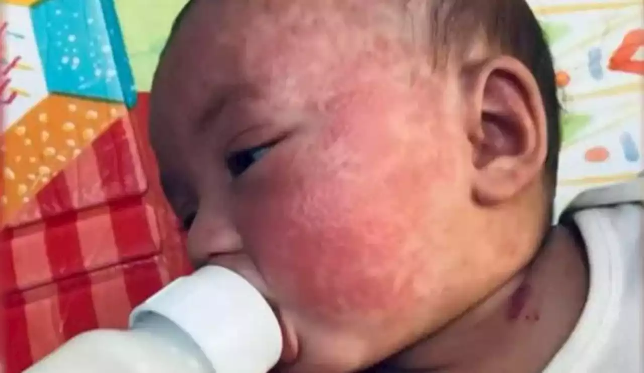 Mother turns to social media as baby formula shortage grows