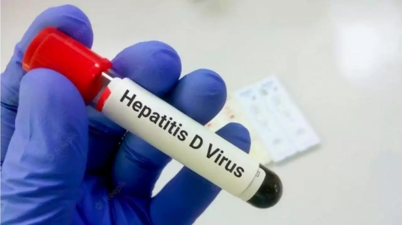 WHO: Sebagian Kasus Hepatitis Akut Pada Anak Tidak Tunjukkan Gejala Demam - Tribunnews.com