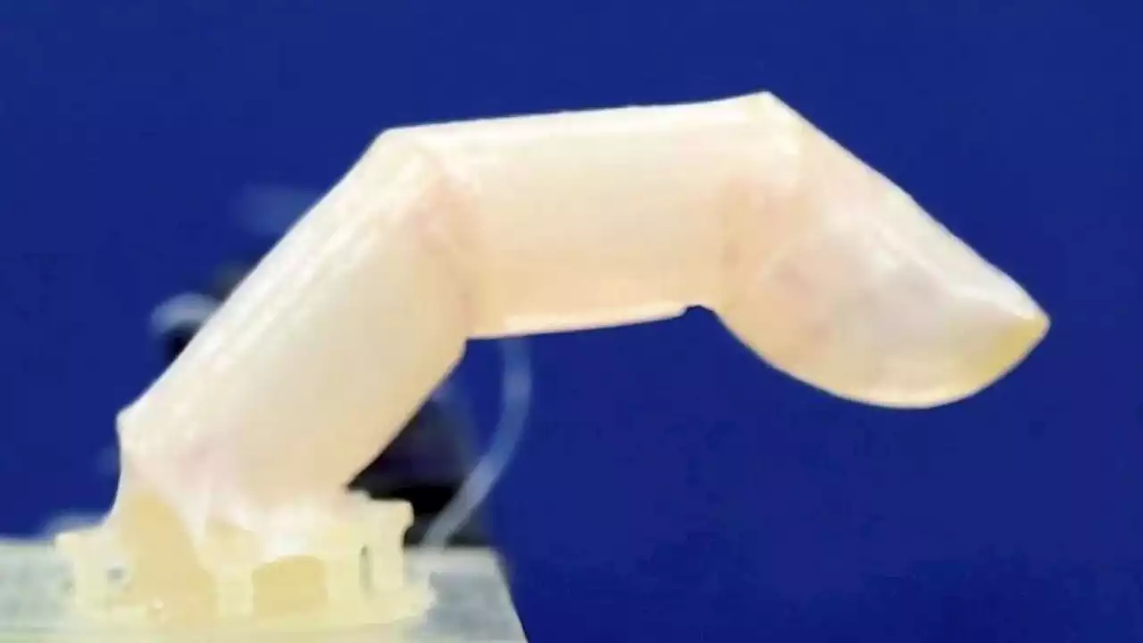 Scientists develop living human skin for robotic finger