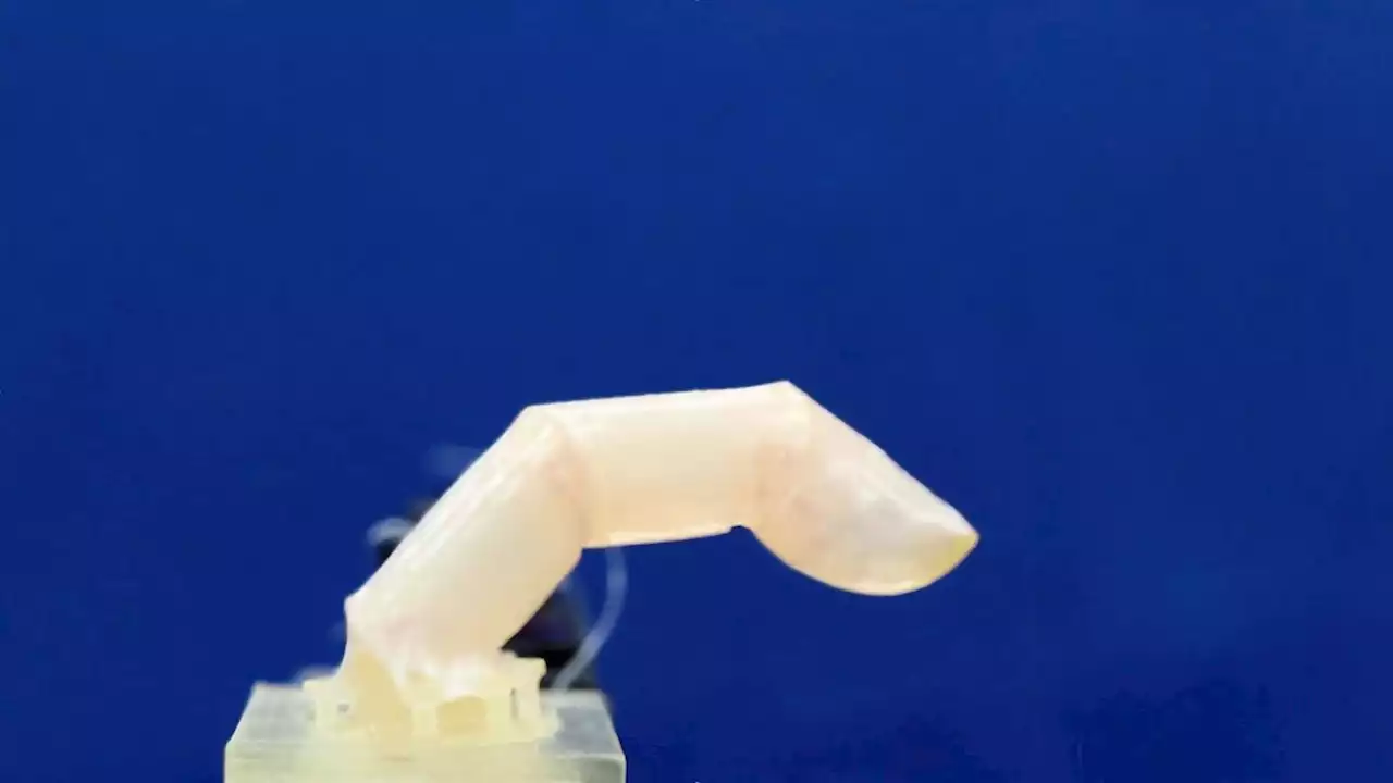 Scientists grew living human skin around a robotic finger