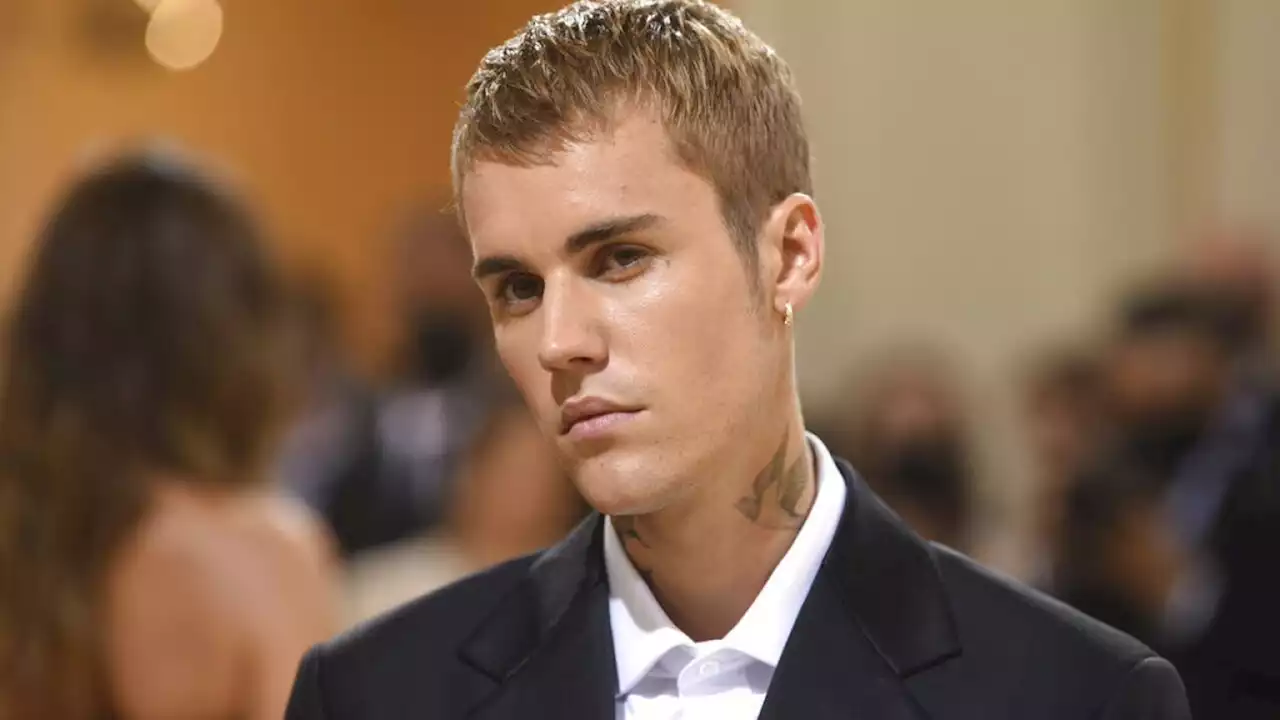 Justin Bieber cancels shows, announces he has facial paralysis