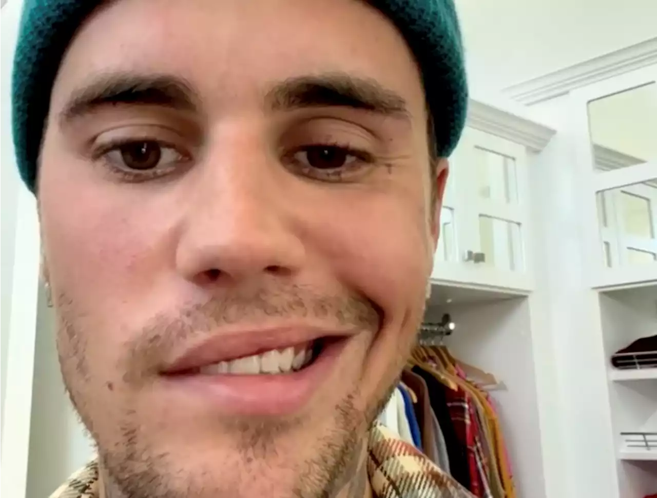 Justin Bieber explains why half of his face isn't functioning, tour on ice