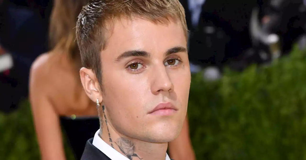 Justin Bieber says half his face is paralyzed due to Ramsay Hunt syndrome