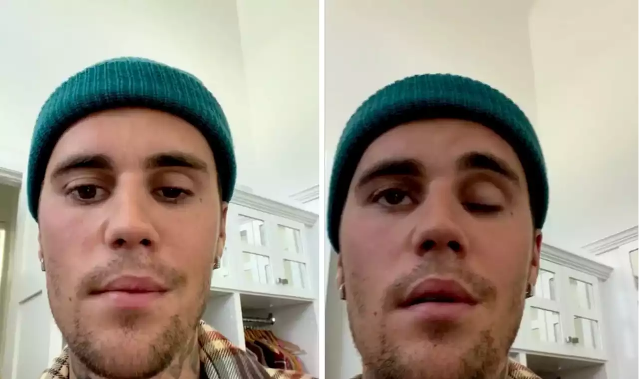 Justin Bieber urges fans 'pray for him' as star's face left paralysed and unable to eat