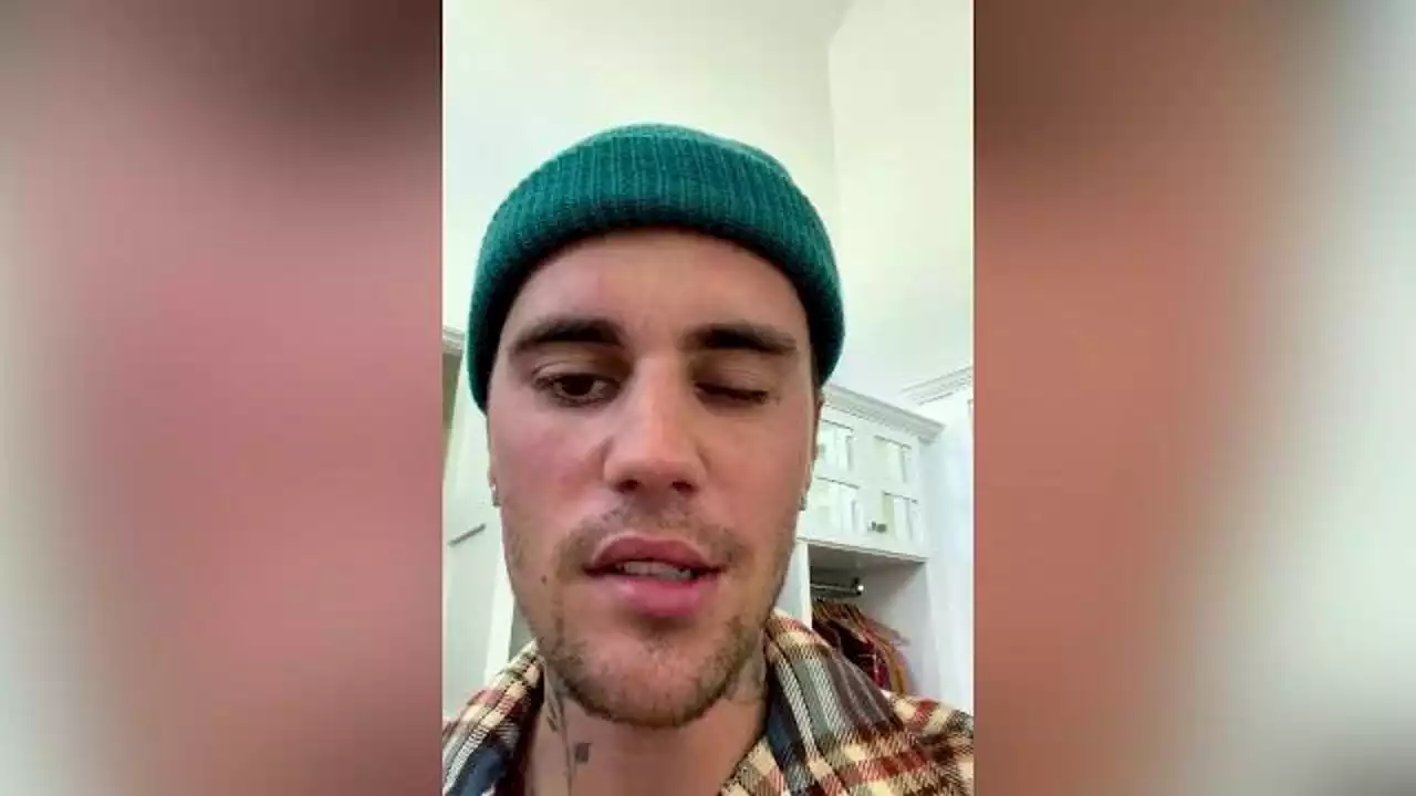 Justin Bieber con volto paralizzato: 'Ho sindrome di Rasmay Hunt'