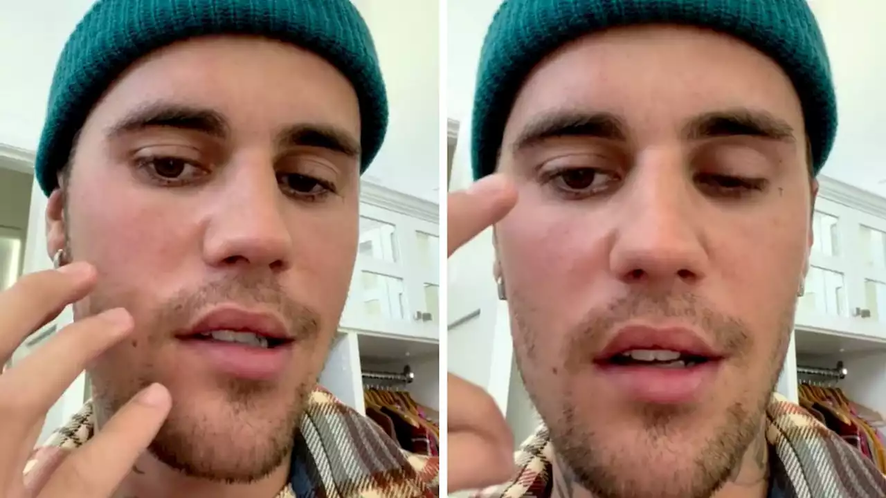 'This is pretty serious': Justin Bieber reveals face paralysis in shock video to fans