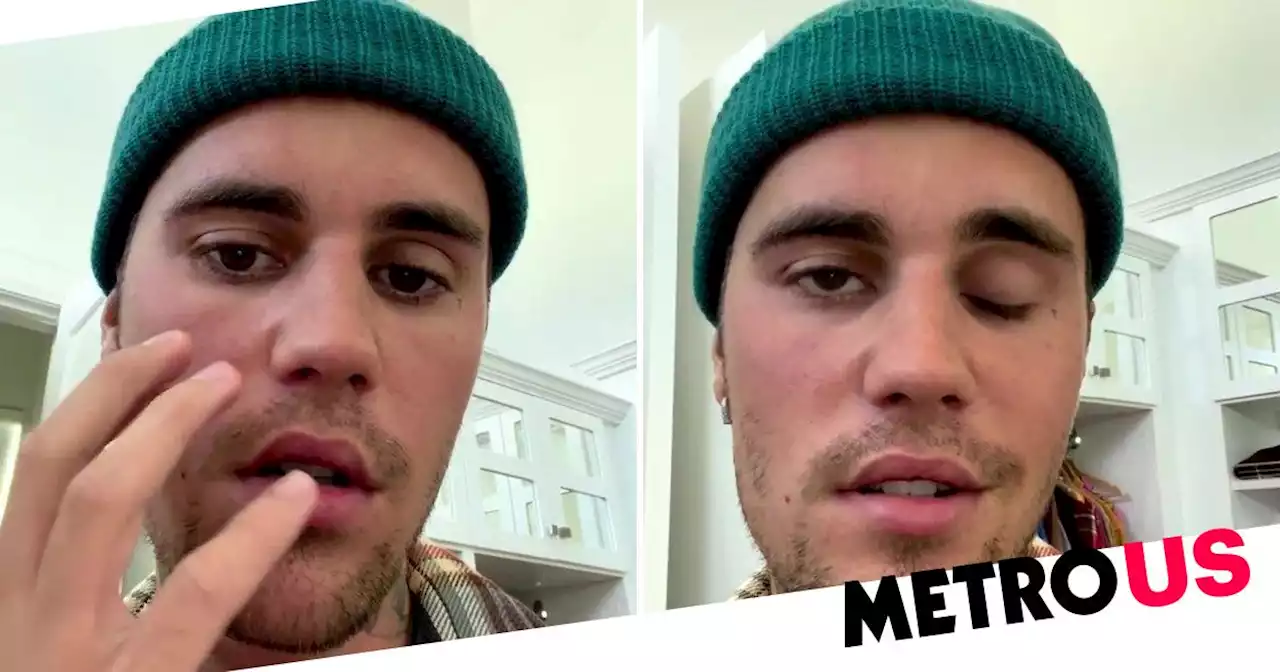 Justin Bieber reveals facial paralysis as result of virus after cancelling shows