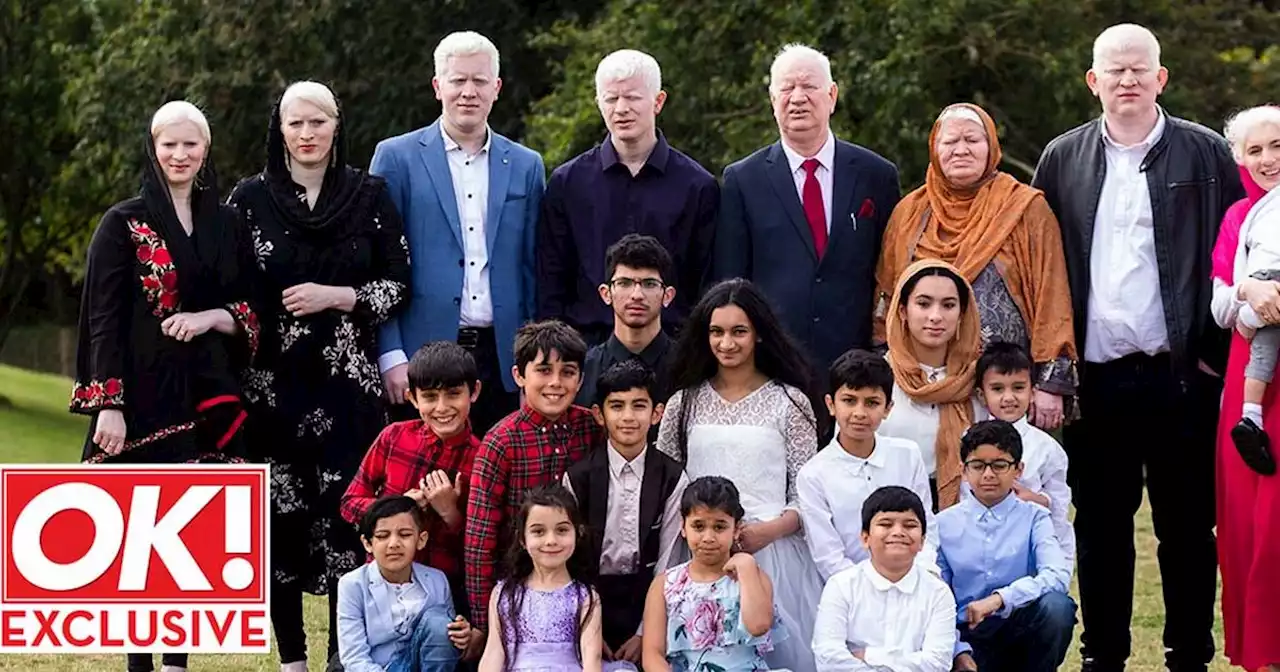 ‘We’re the world’s biggest albino family - growing up was tough’