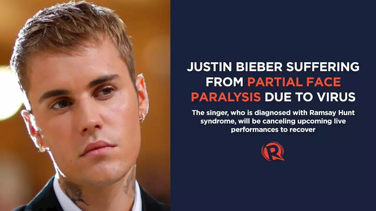 Justin Bieber suffering from partial face paralysis due to virus