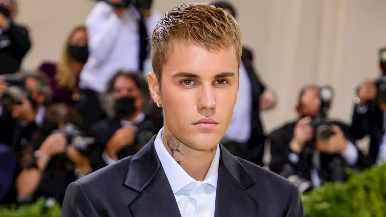 Justin Bieber Is Recovering From Partial Face Paralysis