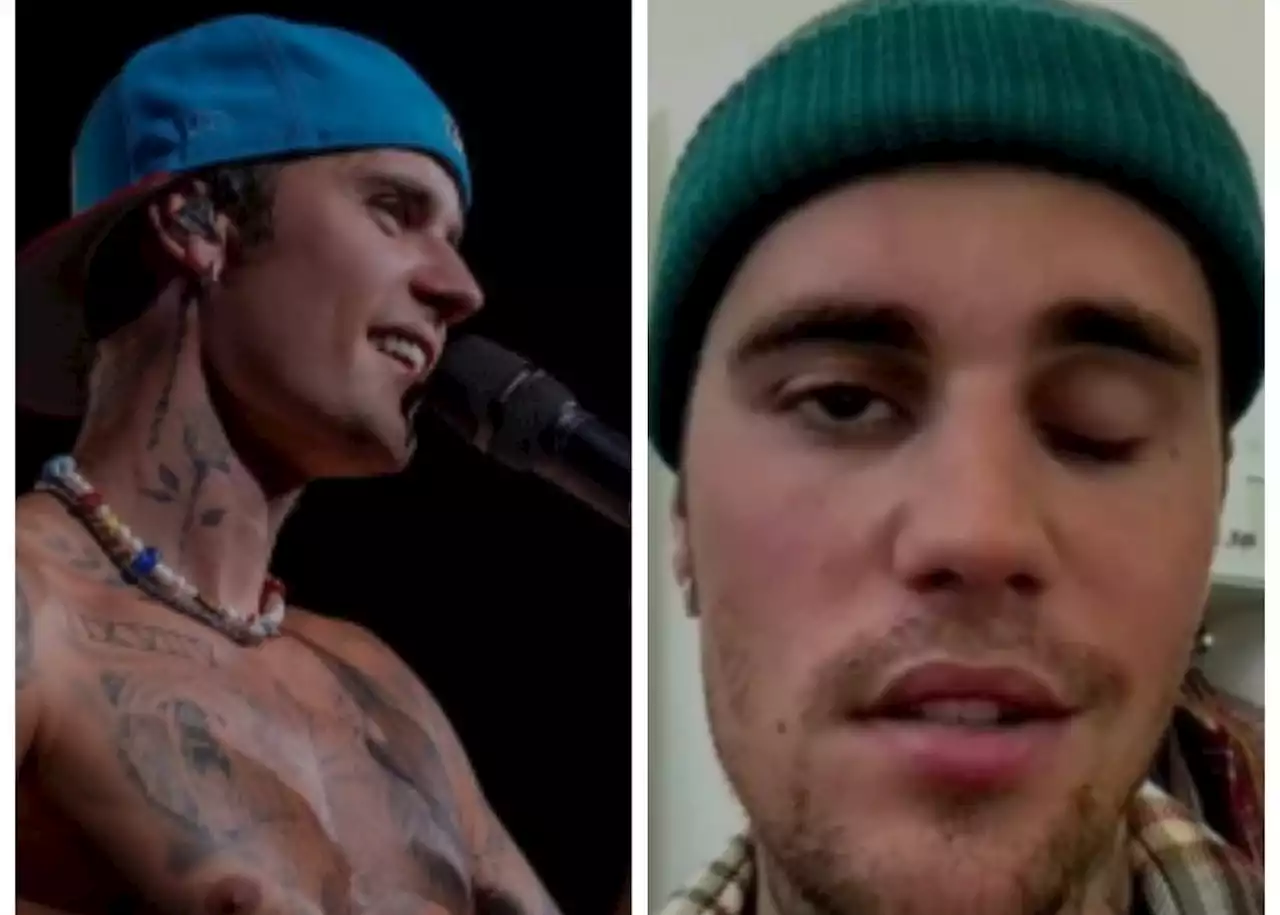 'Keep me in prayers': Justin Bieber reveals shocking facial paralysis [watch]
