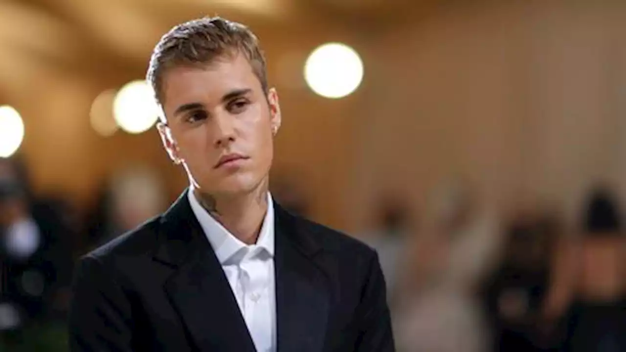 Justin Bieber: Suffering from partial facial paralysis