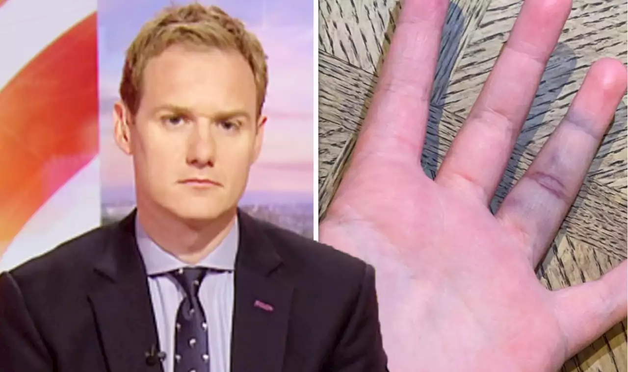 Dan Walker's daughter taken to A&E after injury as host laments at 'four hour wait'