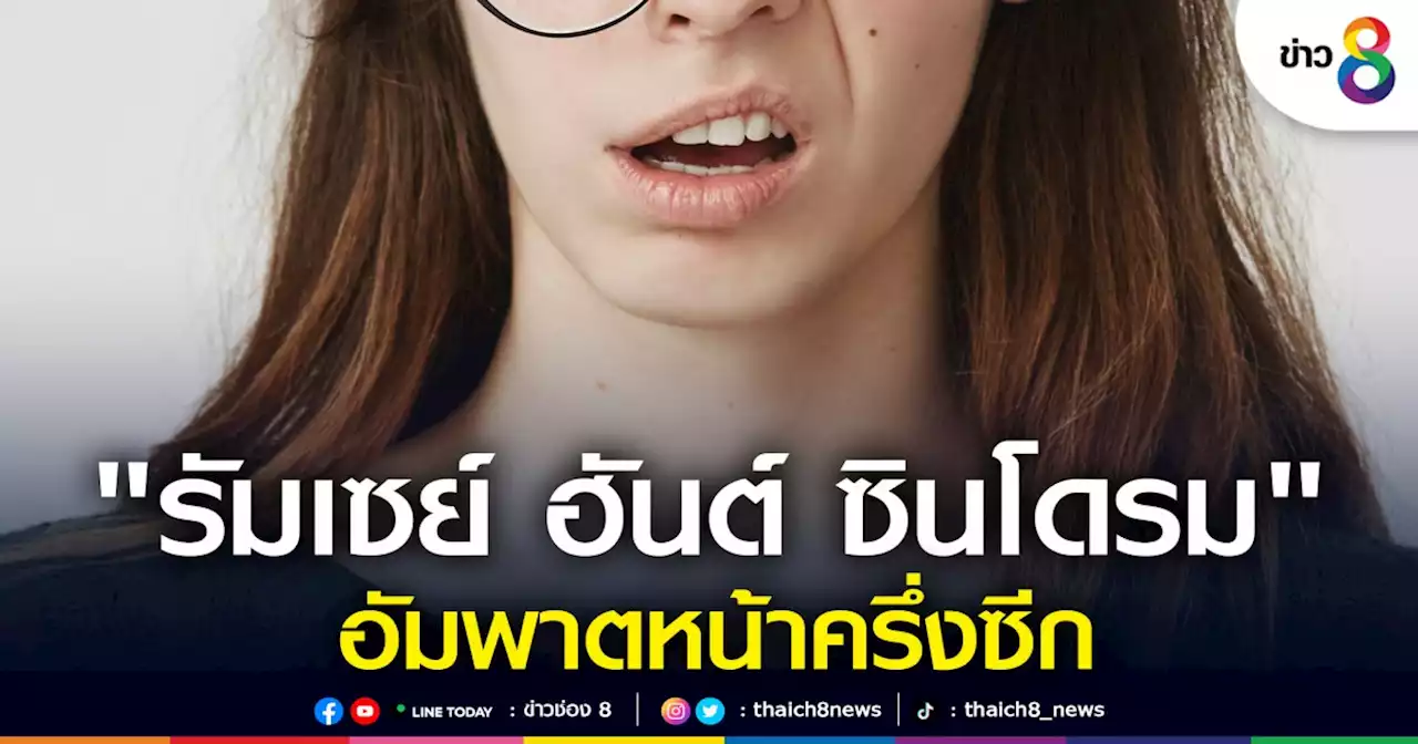 เตือน 'รัมเซย์ ฮันต์ ซินโดรม' เชื้อไวรัสทำลายเส้นประสาท อัมพาตหน้าครึ่งซีก