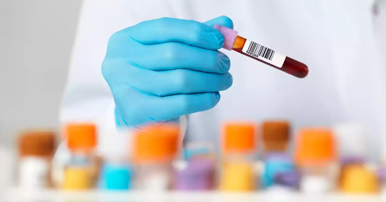 New blood test could indicate how immune you are to Covid