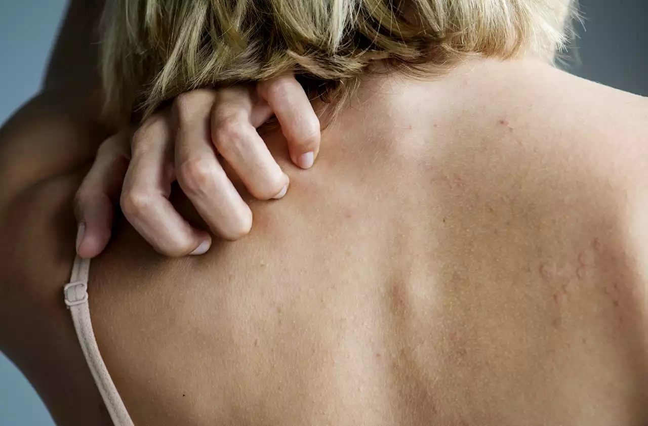 The 6 signs on your SKIN that can be a sign of life-threatening disease