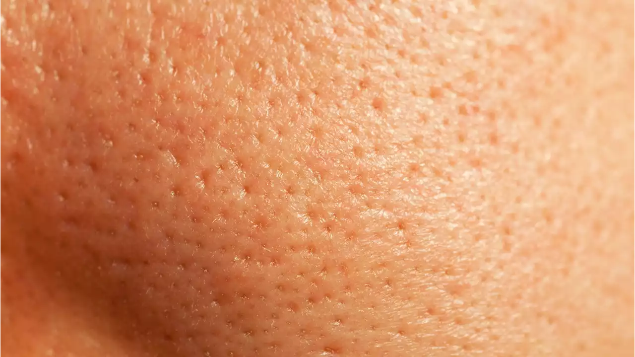 How to get rid of pores, according to the experts