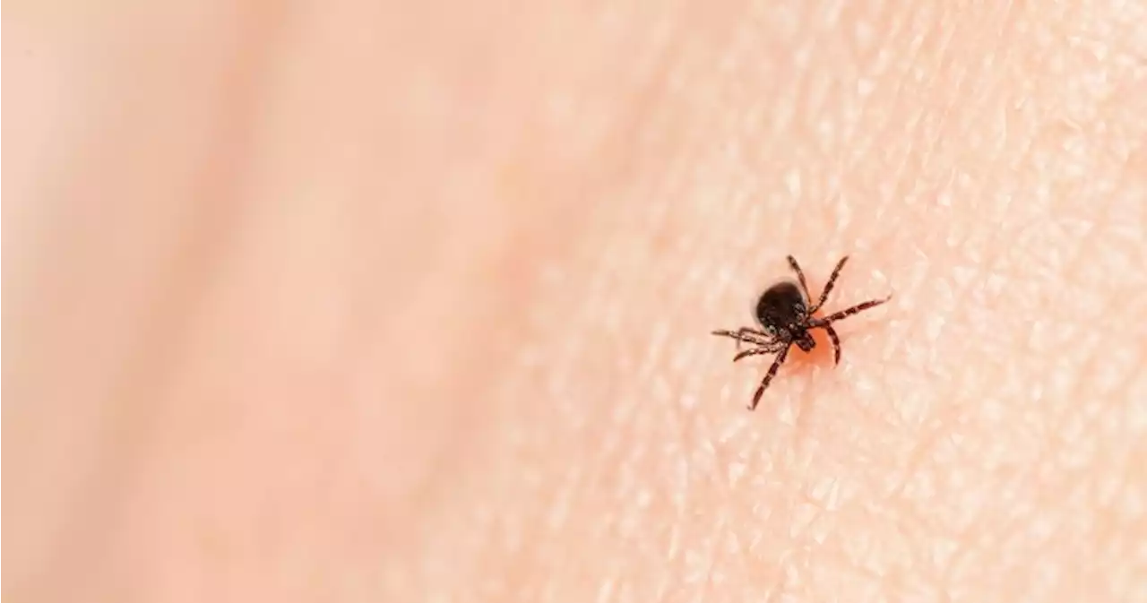 Tick season is here but experts say ‘no reason’ for Canadians to be overly concerned - National | Globalnews.ca