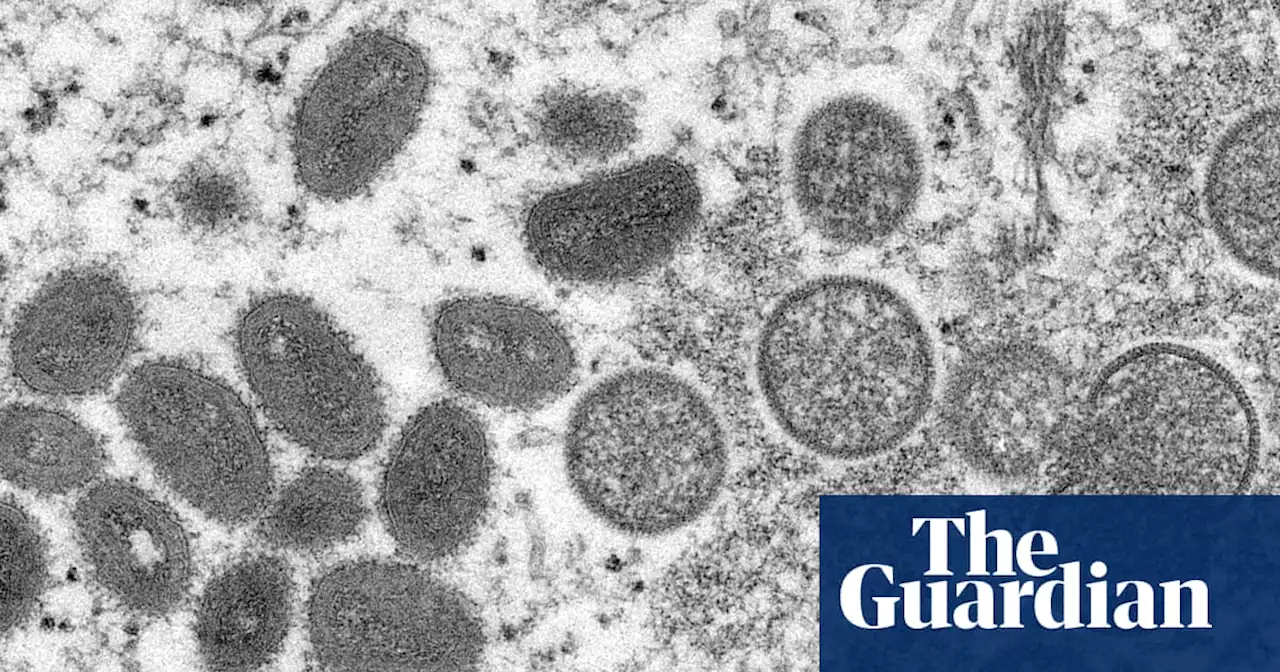 UK monkeypox outbreak not yet under control, say experts