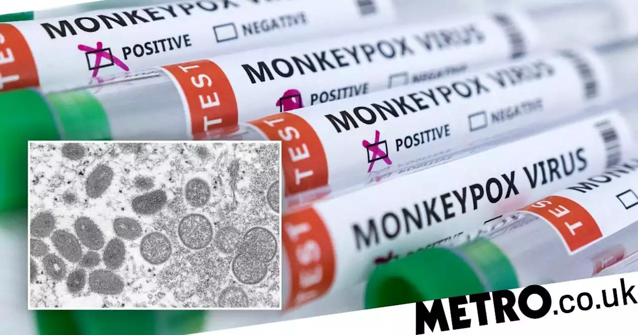 UK monkeypox outbreak is biggest outside Africa and still growing