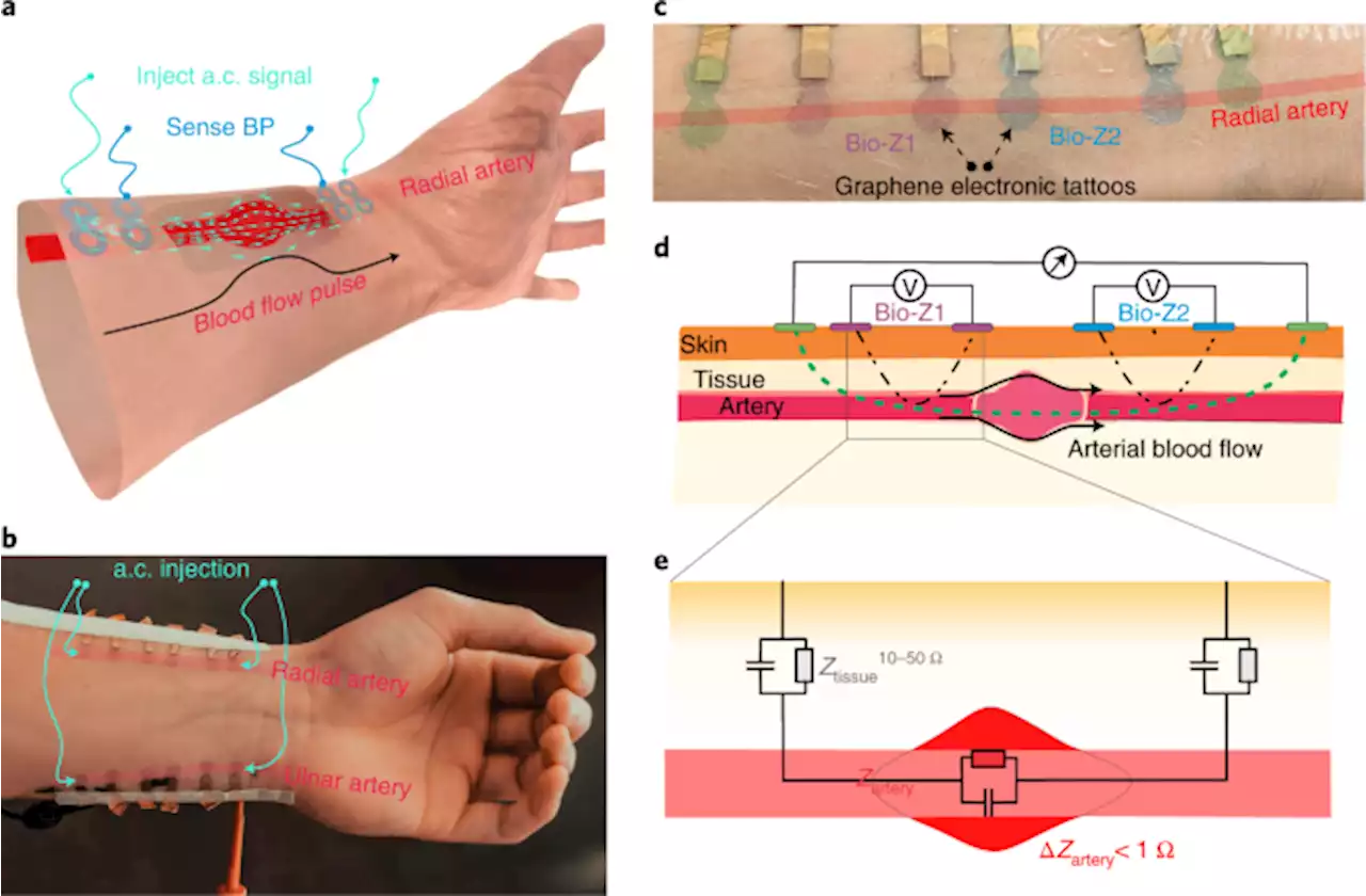 Continuous cuffless monitoring of arterial blood pressure via graphene bioimpedance tattoos - Nature Nanotechnology