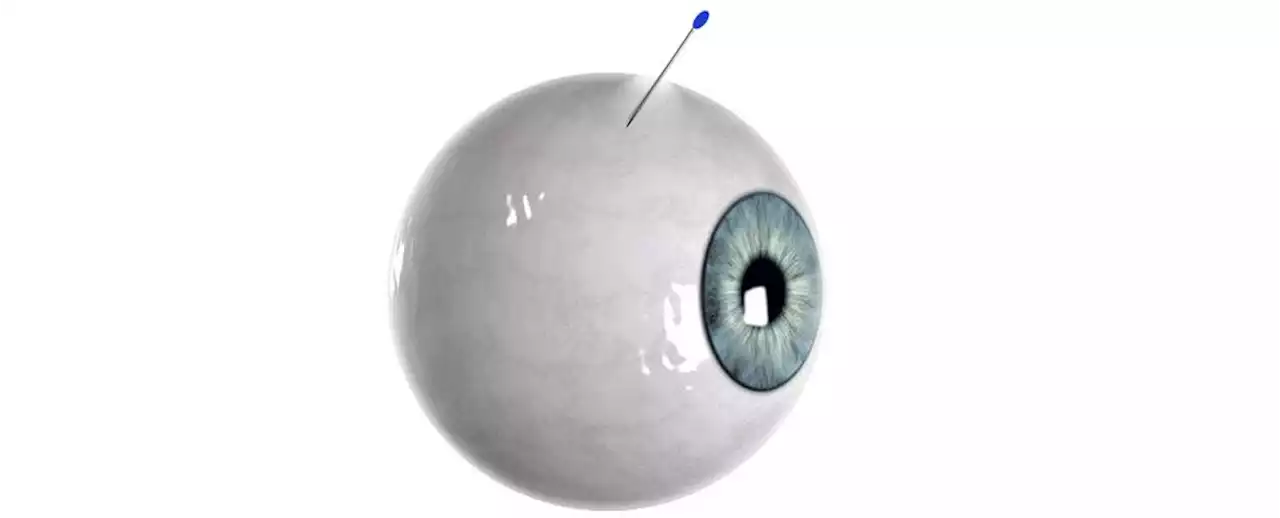 Scientists Created a 'Self-Plugging' Eye Microneedle, And It's as Creepy as It Sounds