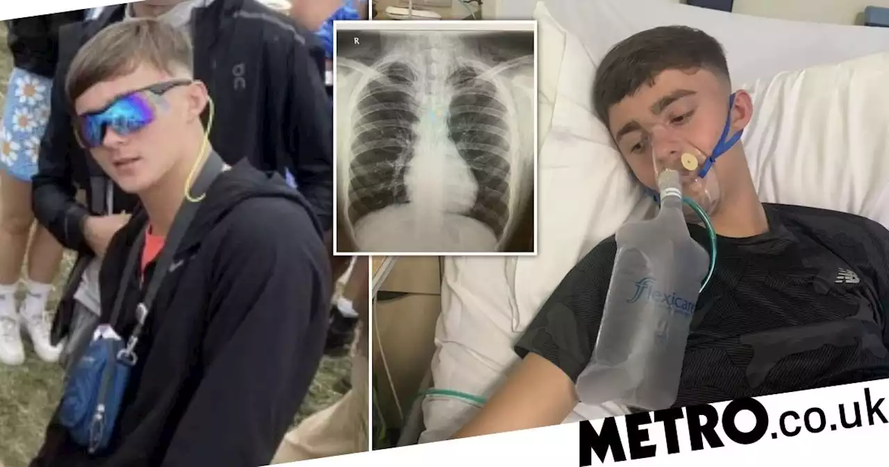 Teen's lung burst after he inhaled laughing gas at Parklife festival