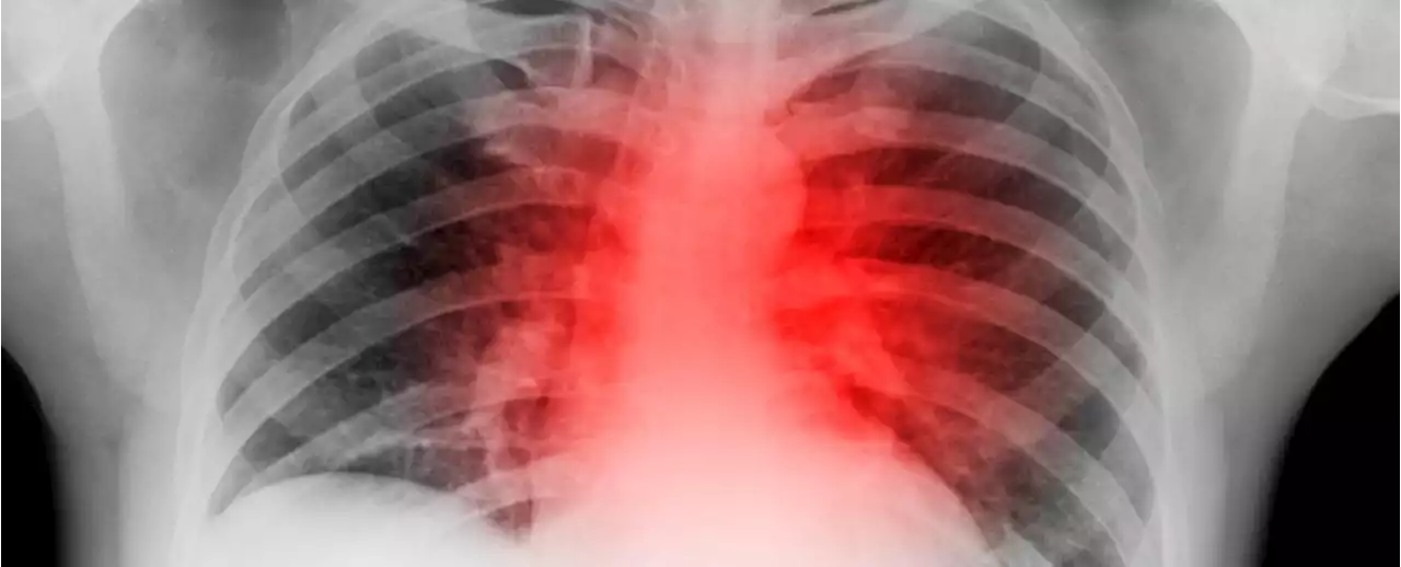 Scientists Have 'Healed' a Heart Attack in Mice by Regenerating Muscle Cells