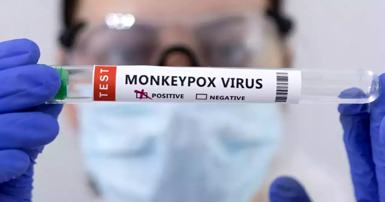 TESTED POSITIVE: First case of monkeypox confirmed in South Africa