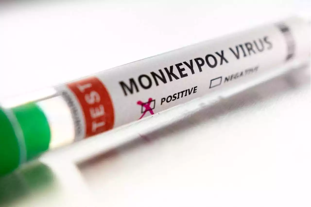 Why monkeypox may soon get a new name