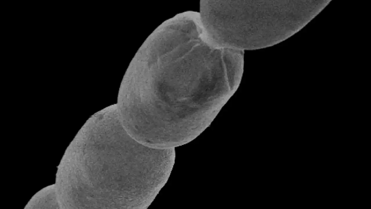 Biggest bacterium ever discovered shakes our view of the single-celled world