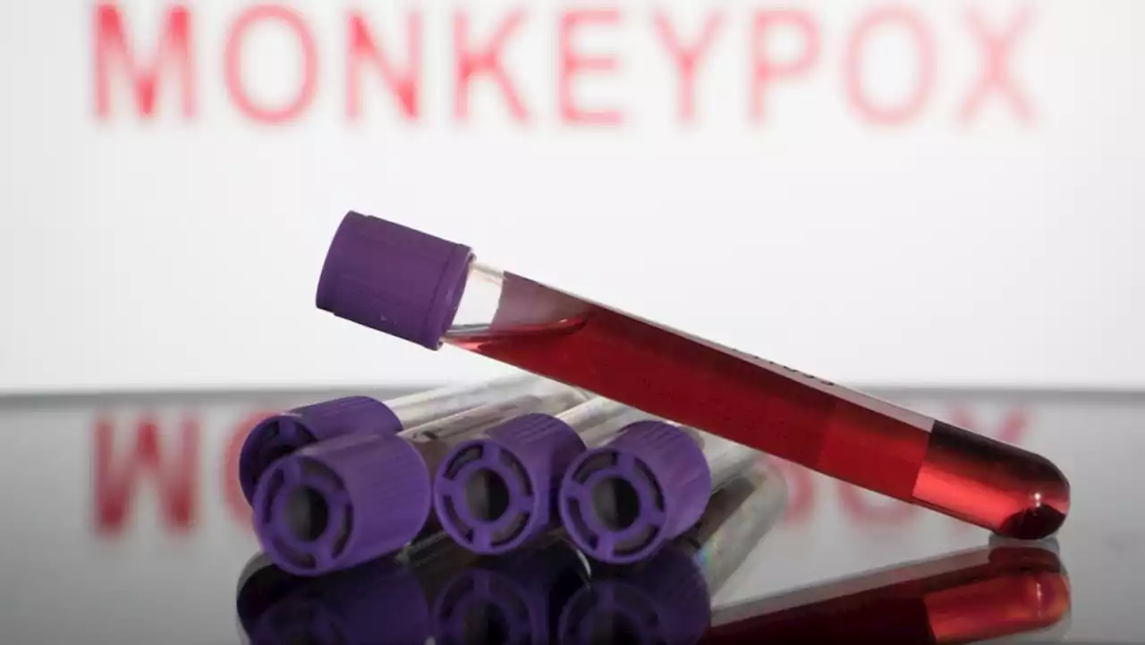 Explainer: What's the global monkeypox situation ahead of WHO decision on whether to declare public health emergency