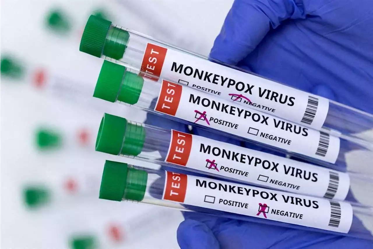 Monkeypox: Our top 10 questions answered | Citypress